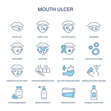 Mouth Ulcer symptoms, diagnostic and treatment vector icon set. Medical icons.