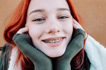 Smiling Redhead Teen Girl with Braces Posing in Warm Winter Clothing