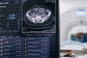 A screen displaying CT or MRI scan images against the backdrop of modern medical equipment. The concept of cutting-edge technologies and precise diagnostics in the field of medicine and healthcare.