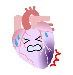 血栓で冠動脈が詰まり心筋梗塞を起こした苦しそうな心臓のイラスト