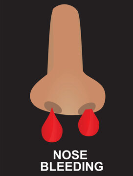 Nose bleeding icon. vector illustration