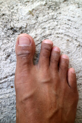 Photo of a man's toes with dark brown skin, slightly dirty