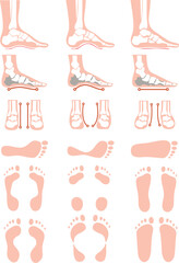 anatomia stopy, deformacje stopy