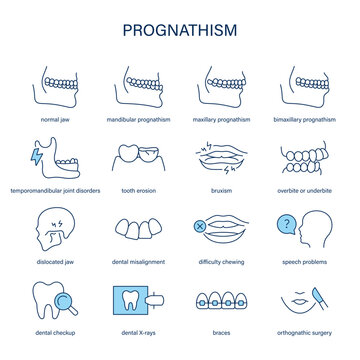 Prognathism symptoms, diagnostic and treatment vector icon set. Medical icons.