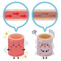 柔らかくて健康な血管と硬くて不健康な血管のキャラクターイラスト