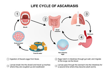 Obraz premium Life cycle of Ascariasis Illustration