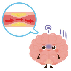 動脈硬化が発生した脳のキャラクター