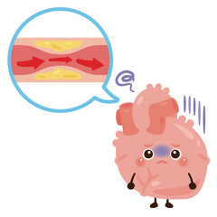 狭心症の心臓のキャラクター