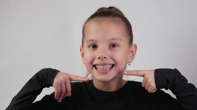 Happy child with dental braces showing thumbs up gesture smiling . Little girl with teeth retainers, smiling, looking at camera, close-up. Child with orthodontic plate on a white background