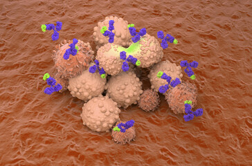 Monoclonal antibody therapy in Breast cancer - isometric view 3d illustration