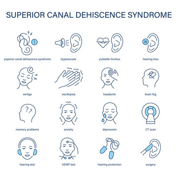 Superior Canal Dehiscence Syndrome symptoms, diagnostic and treatment vector icon set. Medical icons.