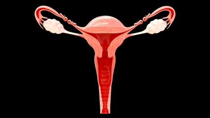 An oophorectomy is a surgical procedure to remove one or both ovaries. It's usually performed to treat ovarian cancer or other ovarian issues.