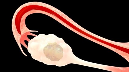 fallopian tube 3d anatomy illustration