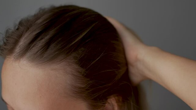 Young blonde woman showing receding hairline on her forehead and temples pushing hair back with her hand. Hair care. A girl demonstrating a healthy scalp and the absence of dandruff. Slow motion