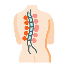 Human Spinal Cord Injury and Back Pain Illustration