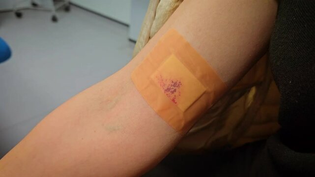 Cut on arm covered with bandage in hospital emergency. Wound treated with adhesive patch in medical facility. Injury secured by plaster in clinical emergency setting. Arm injury dressed with bandage