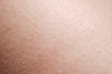 Human dry skin texture close-up.