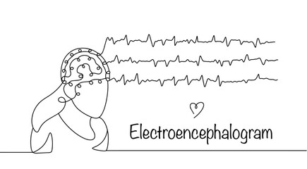 Electroencephalography