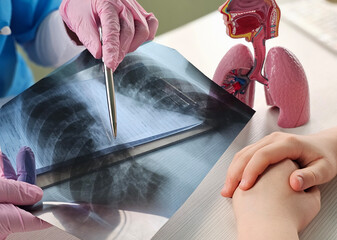 Doctor diagnoses patient's health condition for asthma, lung disease, COVID-19 and , coronavirus or bone cancer using chest x-ray hMPV