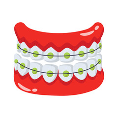Dental braces for teeth alignment and orthodontic treatment
