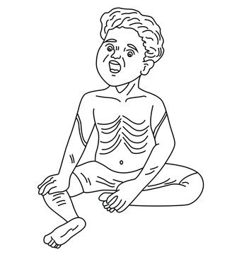 Science of hand drawn vector marasmus disease outline.