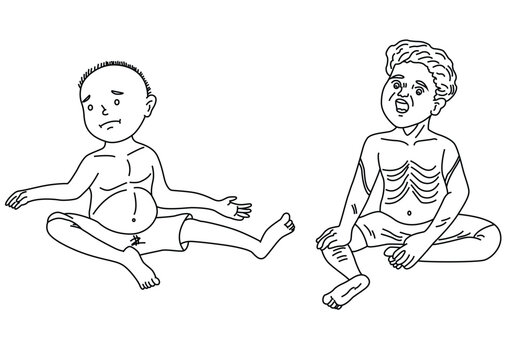 Science of hand drawn vector kwashiorkor and marasmus disease coloring page.