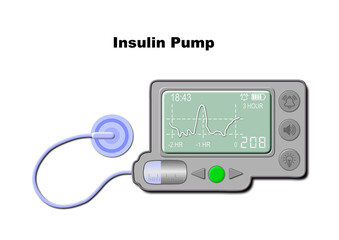 A 3D-rendered illustration of an Insulin pump for personal use, isolated on a white background.