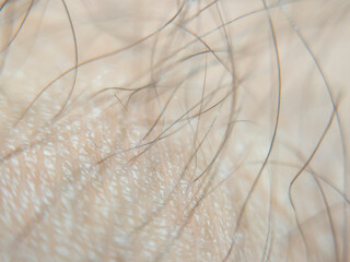 Close-up view of human skin texture with fine hair details, showcasing delicate features and softness. Perfect for beauty and dermatology themes.