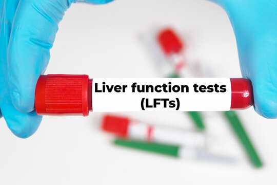 Liver function tests (LFTs) medical analysis value test tube background