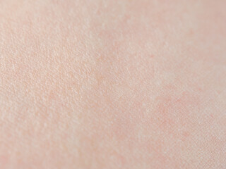 A macro shot of human skin showing the detailed structures, texture and saturation of natural hues.