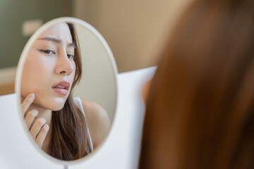Young woman asian are worried about faces Dermatology and allergic to steroids in cosmetics....