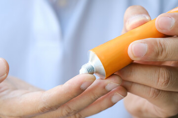 The woman's hand, she is Use steroids Apply External type	
