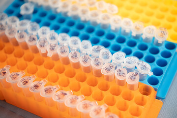 clear plastic vials in yellow blue orange rack holders