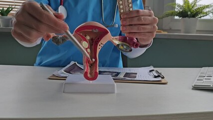 Model of the female reproductive system of the uterus and birth control pills for women. Choosing the best birth control pills for women concept 