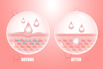 Hyaluronic acid before and after advertising skin solution, pink collagen serum.