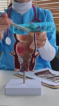 Doctor hands out medicines to patient holding model of rectum 