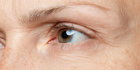 Close-up Image of Human Eye and Periorbital Skin