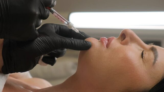 Syringe near woman's chin, beauty injections with fillers for chin shape correction.