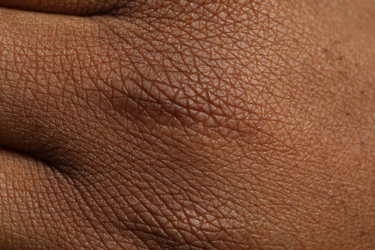 Macro view of normal skin as background