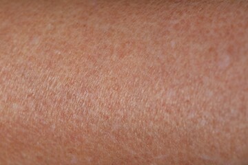 Macro view of dry skin as background