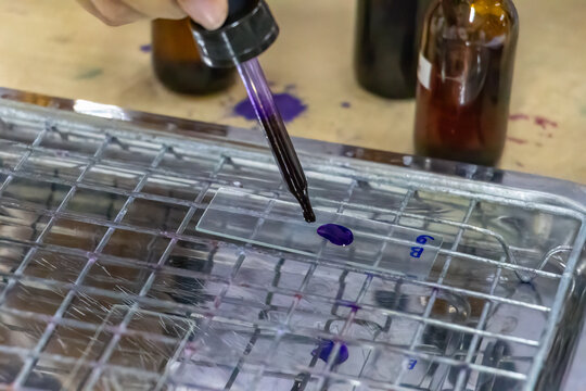Backgrounds of Bacteria and Mold under the microscope in Lab.