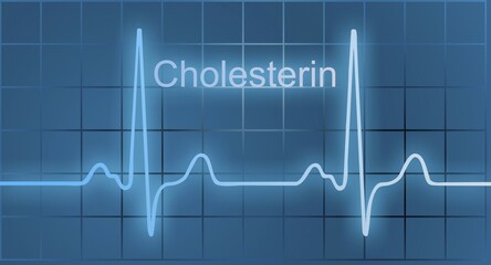 ECG, symbolic picture, Germany, Europe