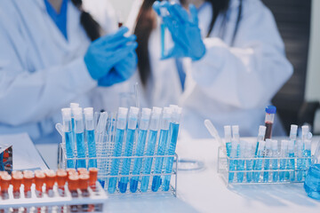 Microbiological research with a test tube and micropipette in close -up