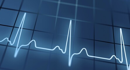 ECG, symbolic picture, Germany, Europe