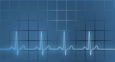 ECG, symbolic picture, Germany, Europe