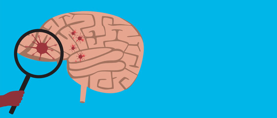 Brain with malignant tumor as oncology concept, flat vector stock illustration or copy space template with brain cancer