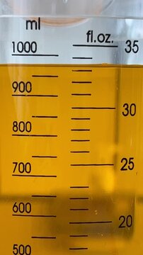 Closeup View of Oral rehydration solutions in Pitcher. Preparing for Diarrhea Patients. Vertical Footage