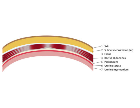 The seven layers of the abdominal wall that must be cut through in order to perform a cesarean section.
