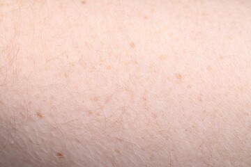 Naklejka premium Texture of healthy skin as background, closeup