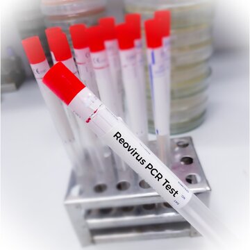 Nasal swab sample for Reovirus Test, Sedoreoviridae. RNA virus, 